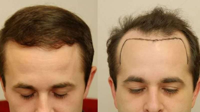 Professional hair unit installation service at barbershop - custom hairpiece fitting and styling by specialist in Queens NYC